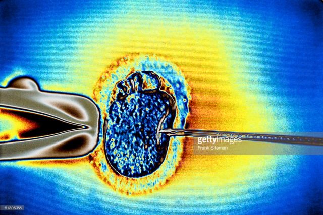 Trusts limit IVF to patients with HIV