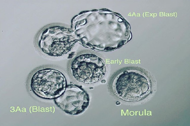 The 4 stages of a Day 5 Embryo at the same time