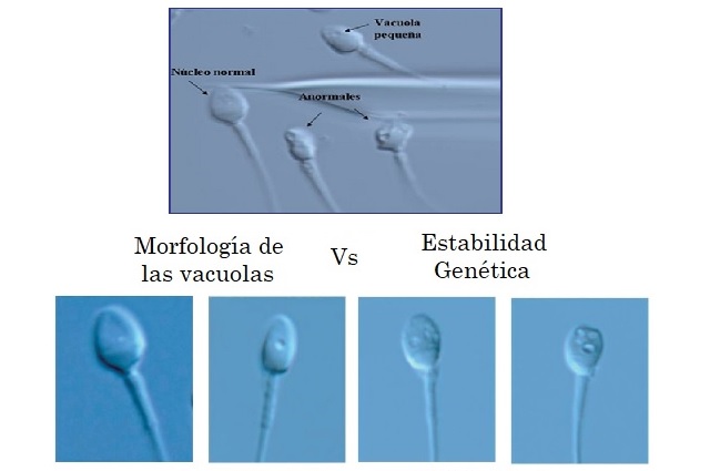 Espermatozoides y vacuolas